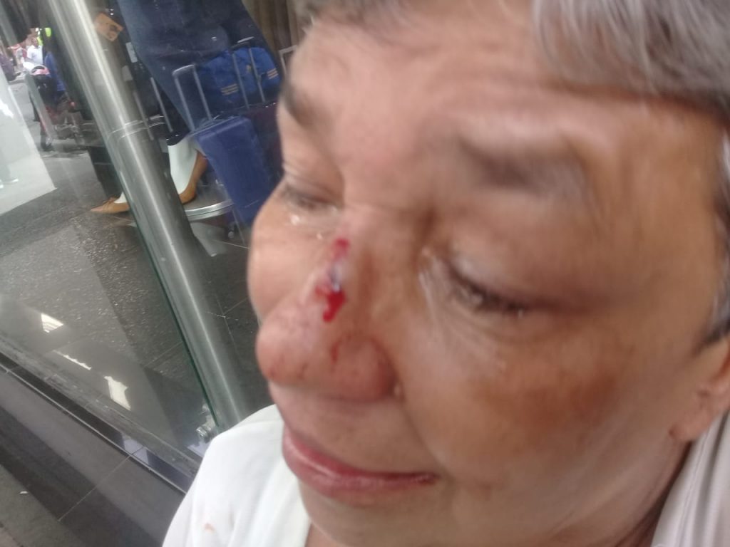 Image result for Por 30 mil pesos, gota a gota golpeÃ³ brutalmente a mujer de 60 aÃ±os en Cali