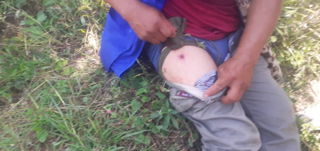 Ataque a minga indígena deja varios heridos en el Cauca