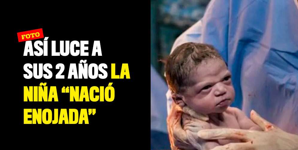 Así-luce-a-sus-2-años-la-niña-nació-enojada